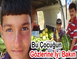 Bu Çocuğun Gözlerine İyi Bakın!