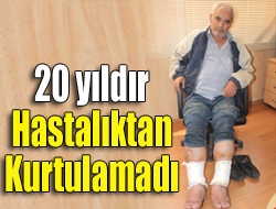 20 yıldır iki bacağındaki venöz yetmezliği hastalığıyla mücadele eden Recep