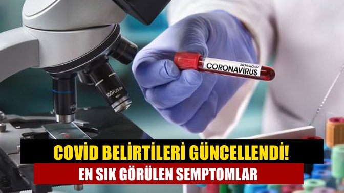 İngiltere Ulusal Sağlık Hizmetleri (NHS) son dönemde artan corona virüs
