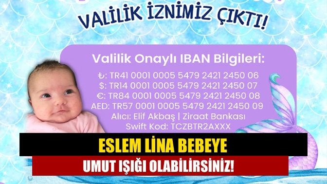 Kandıralı Akbaş çiftinin 3 aylık kızları Eslem Lina, SMA Tip