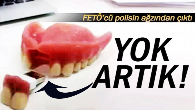 Darbe girişiminin ardından gözaltına alınan bir polisin ağzından takma diş