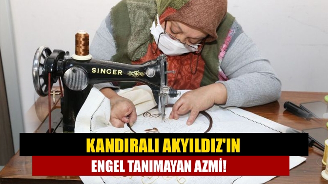 Doğuştan ellerinde bulunan  engel nedeniyle sosyal ortamlarda sıkıntılar yaşayan