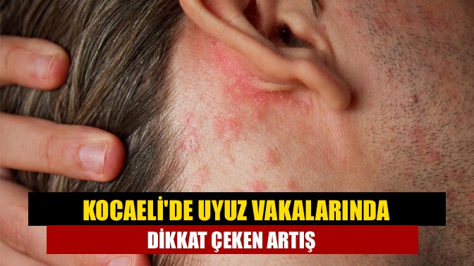 Türkiye genelinde uyuz vakalarında yaşanan yüzde 30'luk artış, Kocaeli'de de